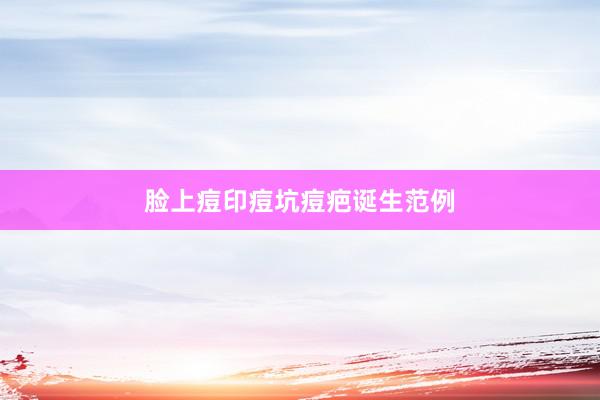 脸上痘印痘坑痘疤诞生范例